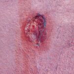 أمين.. الحلم الذي تناثر على جدران القليعة