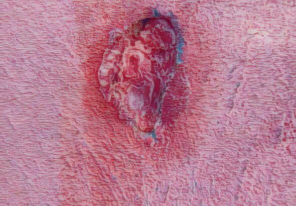 أمين.. الحلم الذي تناثر على جدران القليعة