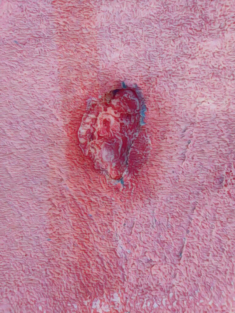 أمين.. الحلم الذي تناثر على جدران القليعة